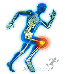 откуда боли в коленном суставе при беге?