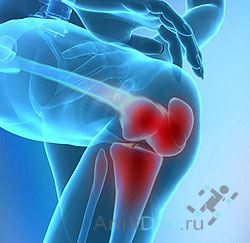 воспаление сустава колена